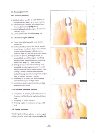 4.4. Tehnlca $abf onului

4.4.i. Aplicarea gablonulul

b)

ftrt6i aplicagi gruadrl de prtz6' (Primer) pe
lntreaga unghie S lrsaf-l sZ se usuce complee
Lidoig Eablonul gi mitlocul lndoit €rigi-l sub

c)

varfrrl unghiei naturale (v.ffg.l'*'{5}.
Potrivlli qablonul cu bola uqghiel El trebuie

d)

Apasati gablonul fest Pe laterdle (v.fi9.{6}.

a) Mii

arate uEor in

si

ic.

v

.L4.2. ilod€lama unghbi artiftclah

a) Turn4i

pugin lichid spedal ln vasul destinat

amestecului.

b)

Scufunda$ virfrrl pensulei mai in€i tu lichidul
specid qi apoi ?n pulbsea de modelar. Rnsuciti
pensula p?nn se forneaza o bib1n, care nu
uebuie sit arate nici prea ude E-i nici prea uscatil.

c) Apt$nd

cu pensula, formali pe Eablon, cu
aceeagi bilup, un varf de ungbie. tmpra+iag
anestecul panl ob$nEi lungimea, grosimea si

d)

forma dorM (v.fi9.17). Irrcrati uniforsL
Preluag din nou materid de modelat Ei acum
aplica$-ltn $trat pe unghia naturale, Ar modul
descris. Lucrati pe direqia pielilei ungbiei, p6ne
ob$neg o trecere uniformit"Evita$ maniirea
pieligei. indnaeli strailt de masi plastice, sub$re,

pani in imediata apropiere a pielitet
e) lndeparag cu un'bedgor dtn lerr*', zubetanp
depusd evennral prea mult pe latcal.

0

fmeaat dupa inchelerea tratamenurlui, curep1i
pensula cu lichid spedal.

4.4.3. Scurtars, nebdrca gi lustsulrca

a) Inm$ straarl de meterial pUuh" sli se uzuce cca.
5 qinute,

l)
c)

varfi{ ardndat al ungtrid usctrdu-se

bine.
inaepartagi cu ater4ie gblonul.
Prelucra$ unghia in continuare , e,
b,c,d'

4..5.

h g:t4.3.3.

Etapeh urmftoalu

Tratali rrnShiile artificide aplicate, crr lac de unghii
colorat, ori cu,lac inolor, a{a ctrm arlat (v.fi9.18}.

292
I

 