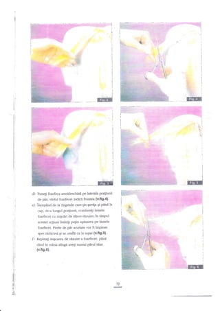 i
d
a

,h

i
I
.i

j

I
I
I

rlTIE
d)

Pune$ foarfeca semidesdrisn

p

lateralzportiunii

de ptq vnrirl foarfecei indict fruntea (v.fig.a)de la degerele care gin $uvip $ pnnlla
cap, de;a lungul portrunii, conduce$ lamele

e) lncepind

fqarfecei cu migceri de t?iiere-rizuire; in timpul
acestei aqiuni int lriti

p4in

apnsarea pe lamele

foarfecei. Firele de pdr scurtate vor'fi impinse
spre niddcint gi se umfltr calz tayx (v.fi9.5).

O

RepetaEi migcarea de rilzrrire a foarfecei,

pdni

cand in m6na s$ngi avegi numai pnrul tniat

{v.fi9.6}.

72
il

 