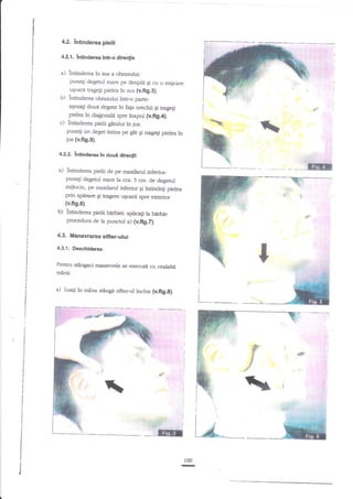 4.2. lntinderea pietii
4.2.1.' lntinderea intr-o dlreclie
j

j

a) intinderea in sus a obrazului:

i

punegi degetul mare pe t6.mph gi cu o miEcare

j

uEoari tragegi pielea in sus (v.fi9.3).
intinclerea obrazului intr-o parte:

b)

aqezali doue degere in fap urechii
Ei uagefi
pielea in diagonala spre inapoi (v.fig.4).
c) lntinderea pielii girului in josr
puneg un deget intins pe gat rrage$ pielea
$i
jos {v.fig.5).

4.2.2. lntinderca tn doud

a)

,',.%
in

rc

dhe{li

fe*r

L-_'....*-

intinderea pielii de pe maxilarul inferior:
puneg degetul mare la cca, 5 crn. de degetul
mijlociu, pe maxilarul inferior gi intindegi pielea

pfin apasarc qi tragere u$oare spre errerior
(v.ftg.6).

b)

intinderea pielii b'Irbiei: aplicagi la Mrbie
procedura de la puncul a) (v.fig.fl.

4.3. Manevralea sifter-ului
43.1.. Desc*riderea
Pentru stingaci manevrele se executii cu cealaltl

rnin{:

a)

Lua$ tn mina $anCa sifter-ul inchis (v.fig.g).

I
I

Ei

SF

H

F

I

d

i
I
I
I





k

-GEfl

I

I
I

I

J

100
IN

 