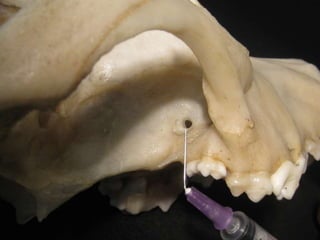 Técnica – Mandíbula
Nervo alveolar inferior
Forâme mandibular – Bloqueio regional caudal
 