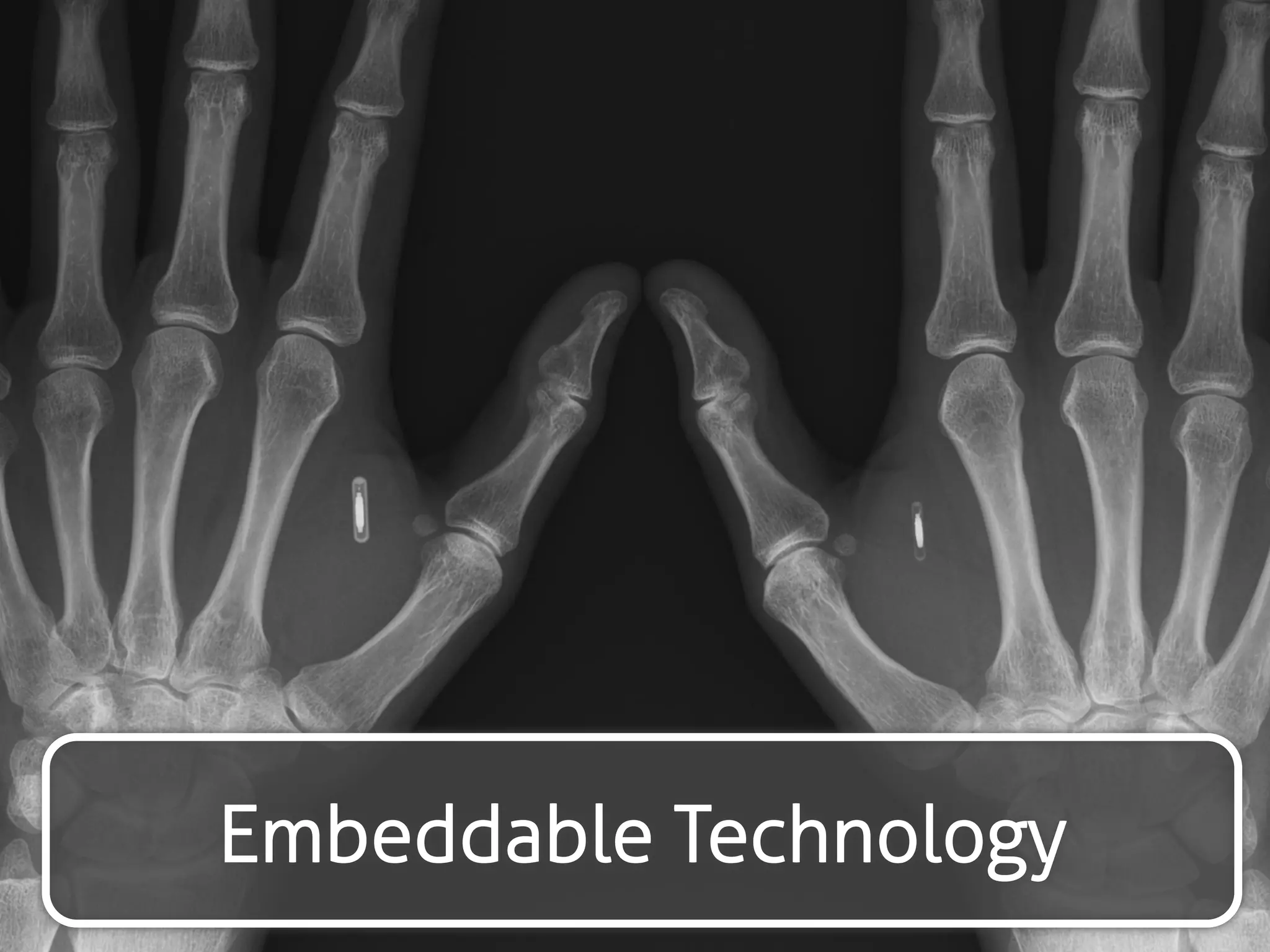 Embeddable Technology 
 