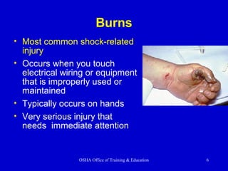 OSHA Office of Training & Education 6
Burns
• Most common shock-related
injury
• Occurs when you touch
electrical wiring or equipment
that is improperly used or
maintained
• Typically occurs on hands
• Very serious injury that
needs immediate attention
 