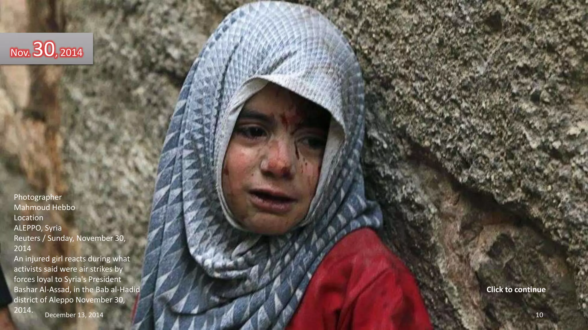 Nov. 30, 2014 
Photographer 
Mahmoud Hebbo 
Location 
ALEPPO, Syria 
Reuters / Sunday, November 30, 
2014 
An injured girl reacts during what 
activists said were air strikes by 
forces loyal to Syria's President 
Bashar Al-Assad, in the Bab al-Hadid 
district of Aleppo November 30, 
2014. 
Click to continue 
December 13, 2014 10 
 