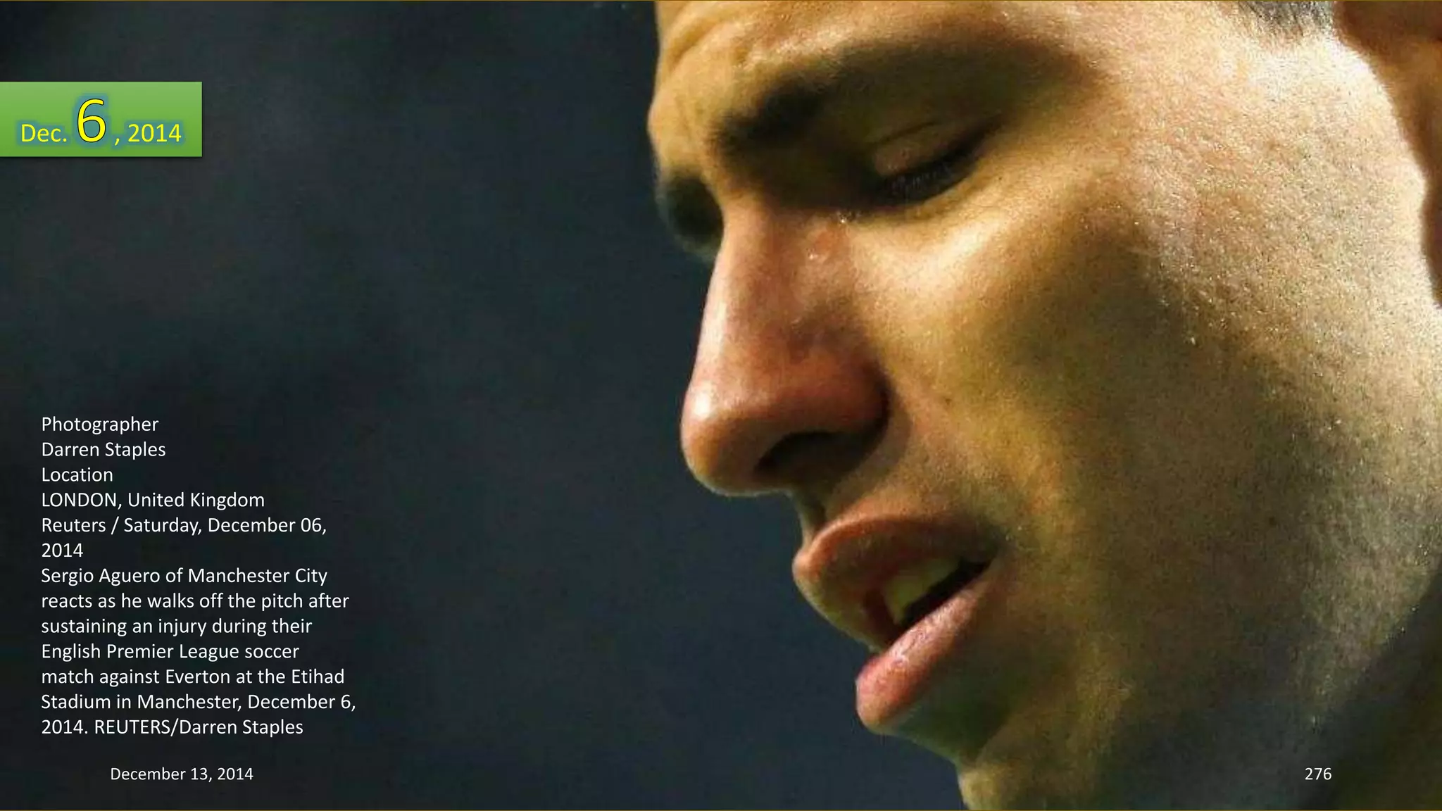 Dec. , 2014 
Photographer 
Darren Staples 
Location 
LONDON, United Kingdom 
Reuters / Saturday, December 06, 
2014 
Sergio Aguero of Manchester City 
reacts as he walks off the pitch after 
sustaining an injury during their 
English Premier League soccer 
match against Everton at the Etihad 
Stadium in Manchester, December 6, 
2014. REUTERS/Darren Staples 
December 13, 2014 276 
 
