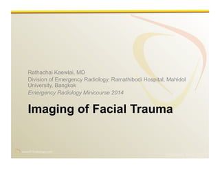 www.RiTradiology.com	

www.RiTradiology.com	

Imaging of Facial Trauma
Rathachai Kaewlai, MD
Division of Emergency Radiology, Ramathibodi Hospital, Mahidol
University, Bangkok
Emergency Radiology Minicourse 2014
Updated May 2014
 