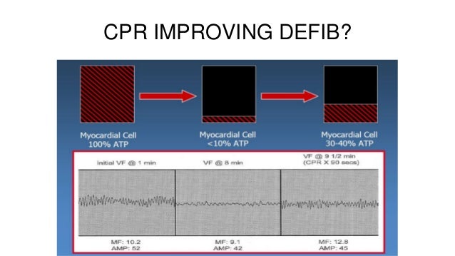 a discussion on the importance of cpr Although advances in emergency cardiac care continue to improve the chances of surviving cardiac arrest, cardiac. a discussion on the importance of cpr Although advances in emergency cardiac care continue to improve the chances of surviving cardiac arrest, cardiac.