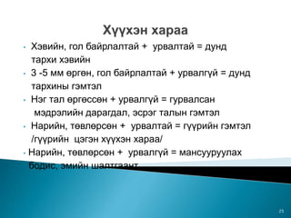 • Хэвийн, гол байрлалтай + урвалтай = дунд
тархи хэвийн
• 3 -5 мм өргөн, гол байрлалтай + урвалгүй = дунд
тархины гэмтэл
• Нэг тал өргөссөн + урвалгүй = гурвалсан
мэдрэлийн дарагдал, эсрэг талын гэмтэл
• Нарийн, төвлөрсөн + урвалтай = гүүрийн гэмтэл
/гүүрийн цэгэн хүүхэн хараа/
• Нарийн, төвлөрсөн + урвалгүй = мансууруулах
бодис, эмийн шалтгаант
25
 