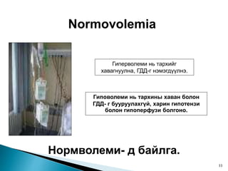 Normovolemia
Нормволеми- д байлга.
Гиперволеми нь тархийг
хавагнуулна, ГДД-г нэмэгдүүлнэ.
Гиповолеми нь тархины хаван болон
ГДД- г бууруулахгүй, харин гипотензи
болон гипоперфузи болгоно.
33
 