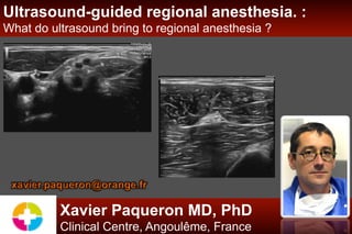 Xavier Paqueron MD, PhD
Clinical Centre, Angoulême, France
Ultrasound-guided regional anesthesia. :
What do ultrasound bring to regional anesthesia ?
xavier.paqueron@orange.fr
 