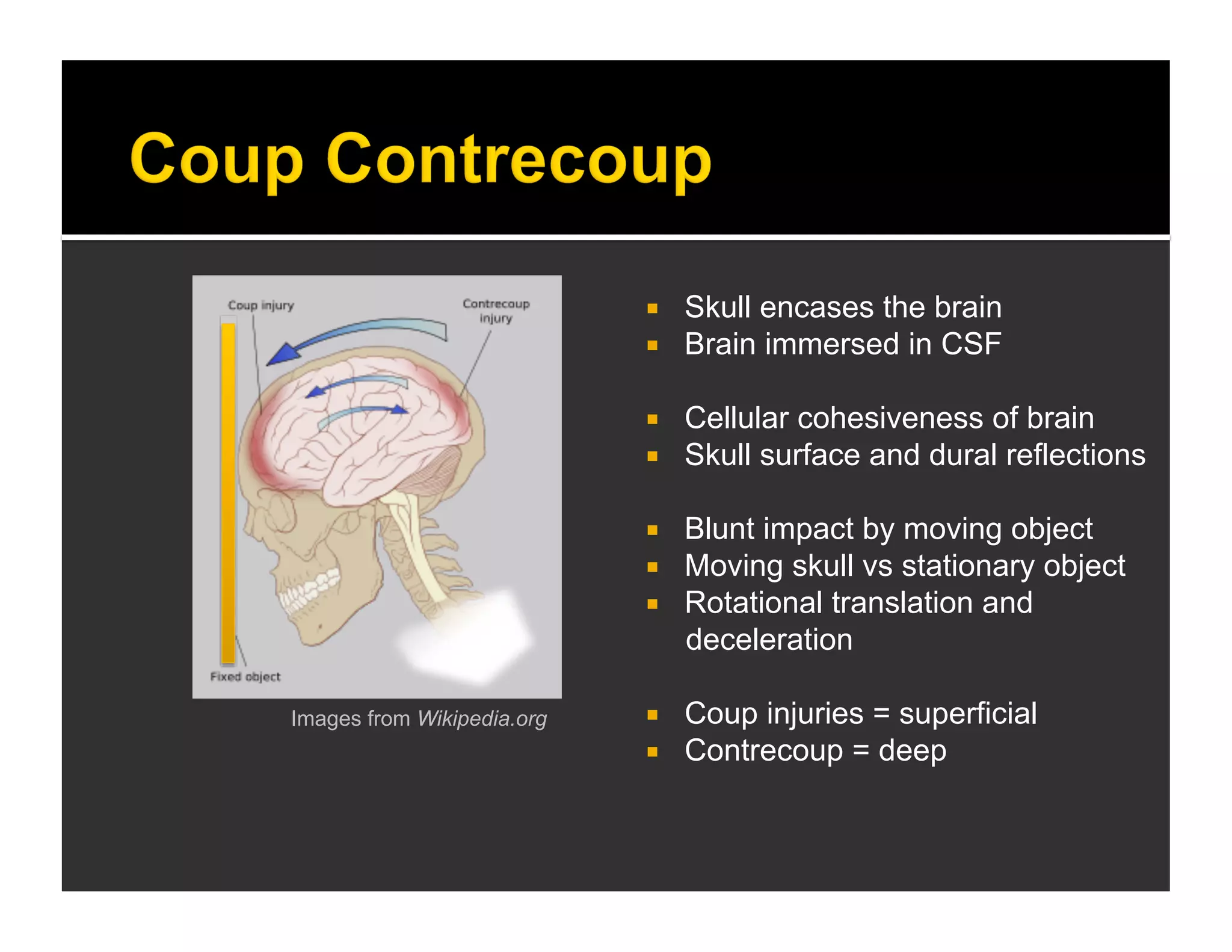  Skull encases the brain 
 Brain immersed in CSF 
 Cellular cohesiveness of brain 
 Skull surface and dural reflections 
 Blunt impact by moving object 
 Moving skull vs stationary object 
 Rotational translation and 
deceleration 
 Coup injuries = superficial 
 Contrecoup = deep 
Images from Wikipedia.org 
 