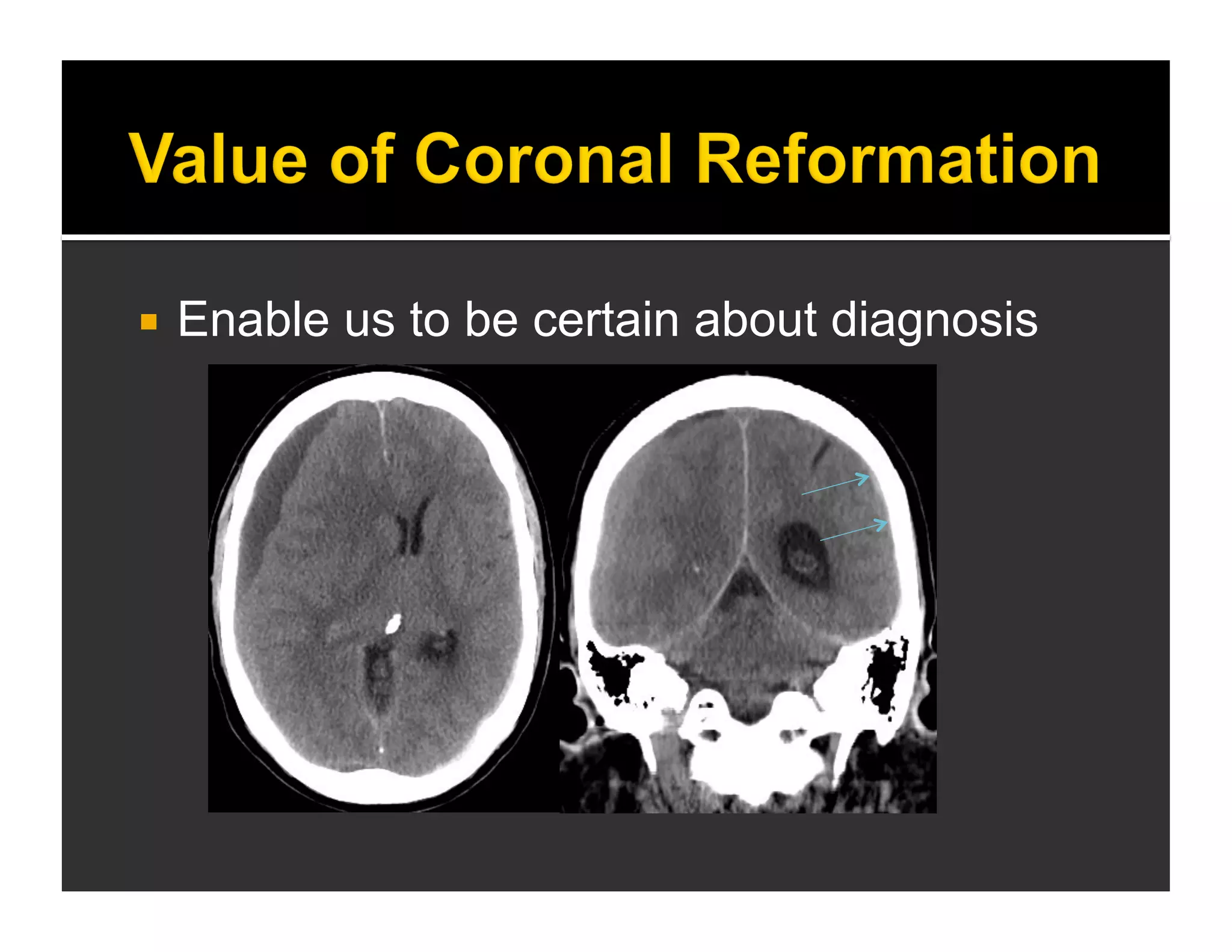  Enable us to be certain about diagnosis 
 