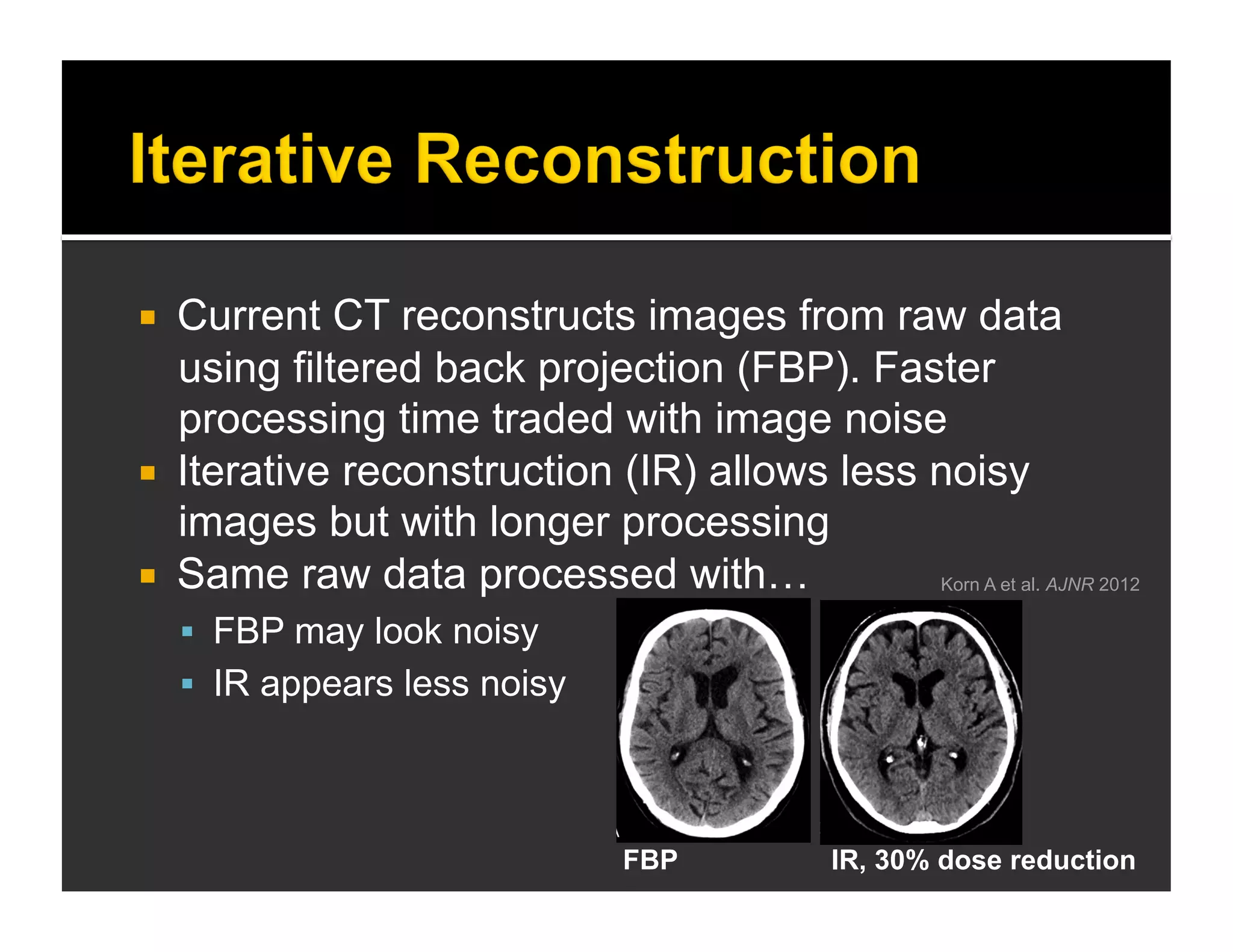  Current CT reconstructs images from raw data 
using filtered back projection (FBP). Faster 
processing time traded with image noise 
 Iterative reconstruction (IR) allows less noisy 
images but with longer processing 
 Same raw data processed with… 
 FBP may look noisy 
 IR appears less noisy 
Korn A et al. AJNR 2012 
FBP IR, 30% dose reduction 
 
