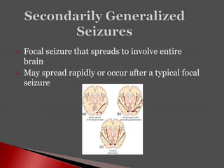  Focal seizure that spreads to involve entire
brain
 May spread rapidly or occur after a typical focal
seizure
 
