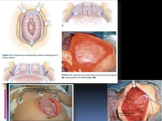 trauma general, cuello y torax.