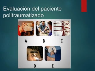 Evaluación del paciente
politraumatizado
 