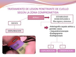 TRATAMIENTO DE LESION PENETRANTE DE CUELLO
SEGÚN LA ZONA COMPROMETIDA
ZONA I
SHOCK
EXPLORACION
ESTABILIDAD
HEMODINAMICA
Mas signos y síntomas
Tto selectivo
-Arteriografía cayado aórtico y
grandes vasos.
- traqueobroncoscopia
-Esofagograma
-Esofagoscopia
+ -
EXPLORACION OBSERVACION
 