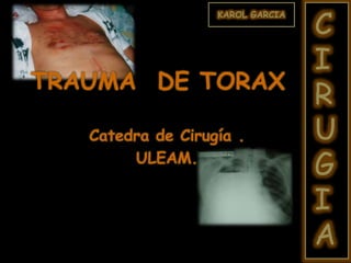 TRAUMA DE TORAX
Catedra de Cirugía .
ULEAM.
KAROL GARCIA
C
I
R
U
G
I
A
 