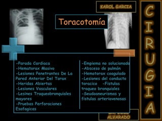 DR. JOSE
ALVARADO
KAROL GARCIA
C
I
R
U
G
I
A
-Parada Cardiaca
-Hematorax Masivo
-Lesiones Penetrantes De La
Pared Anterior Del Torax
-Heridas Abiertas
-Lesiones Vasculares
-Lesines Traqueobronquiales
mayores
-Pruebas Perforaciones
Esofagicas
-Empiema no solucionado
-Absceso de pulmón
-Hemotorax coagulado
-Lesiones del conducto
toracico -Fistulas
traqueo bronquiales
-Seudoaneurismas y
fistulas arteriovenosas
Toracotomía
 