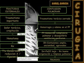 KAROL GARCIA
C
I
R
U
G
I
A
FRACTURAS
ESTERNALES
Traumatismo
importante
Dolor torácico,
crepitación
Hematoma
Rx
Tto Conservador /
reduccion A /
fijacion I
CONTUSION
PULMONAR
Traumatismo torácico cerrado
Hemorragia y edema en el PP
FP=Reducción compliancia
pulmonar y desequilibrio
ventilacion-perfusion
IR=Contusiones amplia,
ancianidad, agravados
Dx=PaO2 baja – Rx buena
oxigenación y limpieza pulmonar
Neumonia
 