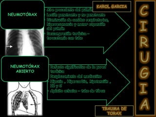 TRAUMA DE
TORAX
C
I
R
U
G
I
A
• Aire procedente del pulmón
• Lesión penetrante y no penetrante
• Disminución de sonidos respiratorios,
hiperresonancia y menor expansión
del pulmón
• Descompresión torácica –
toracotomía con tubo
NEUMOTÓRAX
• Defecto significativo de la pared
torácica
• Desplazamiento del mediastino
• Hipoxia , Hipercarbia, hipotensión ,
IR y C
• Apósito oclusivo – tubo de tórax
NEUMOTÓRAX
ABIERTO
KAROL GARCIA
 