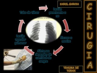 TRAUMA DE
TORAX
KAROL GARCIA
C
I
R
U
G
I
A
Lesión
penetrante o
no
Escasa o
masiva
Síntomas
dependen de
cantidad de
sangre
Lesión
vascular
pulmonar
Tubo de tórax
 