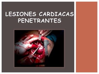 LESIONES CARDIACAS
PENETRANTES
 