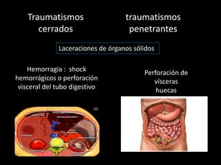 Traumatismos
cerrados
traumatismos
penetrantes
Laceraciones de órganos sólidos
Hemorragia : shock
hemorrágicos o perforación
visceral del tubo digestivo
Perforación de
vísceras
huecas
 