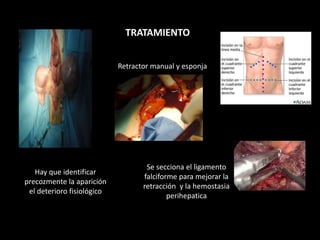 TRATAMIENTO
Se secciona el ligamento
falciforme para mejorar la
retracción y la hemostasia
perihepatica
Retractor manual y esponja
Hay que identificar
precozmente la aparición
el deterioro fisiológico
 