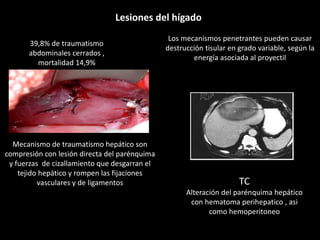Lesiones del hígado
39,8% de traumatismo
abdominales cerrados ,
mortalidad 14,9%
Mecanismo de traumatismo hepático son
compresión con lesión directa del parénquima
y fuerzas de cizallamiento que desgarran el
tejido hepático y rompen las fijaciones
vasculares y de ligamentos
Los mecanismos penetrantes pueden causar
destrucción tisular en grado variable, según la
energía asociada al proyectil
TC
Alteración del parénquima hepático
con hematoma perihepatico , asi
como hemoperitoneo
 