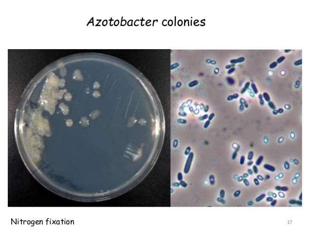 Bacteria - 2015 03-25 (AGB 12022)