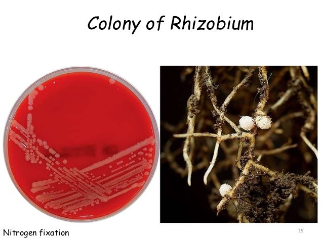 Bacteria - 2015 03-25 (AGB 12022)