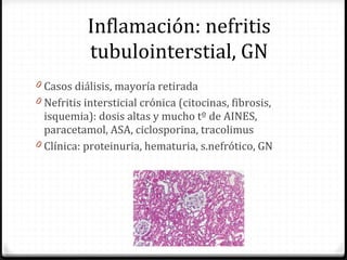 0 Casos diálisis, mayoría retirada
0 Nefritis intersticial crónica (citocinas, fibrosis,
isquemia): dosis altas y mucho tº de AINES,
paracetamol, ASA, ciclosporina, tracolimus
0 Clínica: proteinuria, hematuria, s.nefrótico, GN
Inflamación: nefritis
tubulointerstial, GN
 