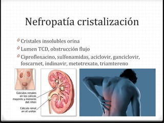 Nefropatía cristalización
0 Cristales insolubles orina
0 Lumen TCD, obstrucción flujo
0 Ciprofloxacino, sulfonamidas, aciclovir, ganciclovir,
foscarnet, indinavir, metotrexato, triamtereno
 