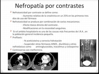 Nefropatía por contrastes
0 Nefrotoxicidad por contraste se define como:
- Aumento relativo de la creatinina en un 25% en los primeros tres
días de uso del fármaco
0 Nefrotoxicidad se produce por combinación de varios mecanismos:
- Efecto tóxico directo del contraste .
- Modificaciones en la viscosidad sanguínea.
0 En el ambito hospitalario es una de las causas más frecuentes de I.R.A , en
la población general incidencia pequeña.
0 Profilaxis:
- N-aceticisteína y correcta hidratación
- Suspender otros fármacos AINES , diuréticos y otros
nefrotóxicos como aminoglucosidos, tracolimus y ciclosporina
0 Controversia con metformina.
 