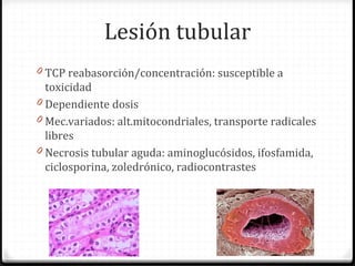 Lesión tubular
0 TCP reabasorción/concentración: susceptible a
toxicidad
0 Dependiente dosis
0 Mec.variados: alt.mitocondriales, transporte radicales
libres
0 Necrosis tubular aguda: aminoglucósidos, ifosfamida,
ciclosporina, zoledrónico, radiocontrastes
 