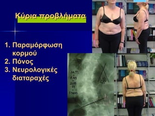 1. Παραμόρφωση
κορμού
2. Πόνος
3. Νευρολογικές
διαταραχές
Κύρια προβλήματα
 