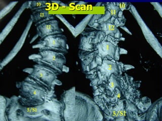 3 mts p.op.
12
11
1
2
3
4
5/S1
10
12
11
1
2
3
4
5/S1
103D - Scan
 