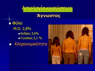Αιτιολογία κυφώσεως
Άγνωστος
 Φύλο
Μ.Ο. 2,8%
 Άνδρες 3,6%
 Γυναίκες 2,1 %
 Κληρονομικότητα 74%
 
