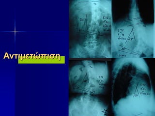 Αντιμετώπιση
 