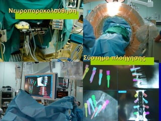 Νευροπαρακολούθηση
Σύστημα πλοήγησης
 