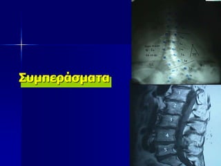 Συμπεράσματα
 