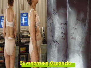 Συντηρητική Θεραπεία
 