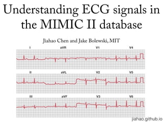 Understanding ECG signals in
the MIMIC II database
Jiahao Chen and Jake Bolewski, MIT
jiahao.github.io
 