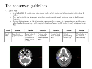 The consensus guidelines
• Level VIIb
– Level VIIb (Table 6) contains the retro-styloid nodes, which are the cranial conti...