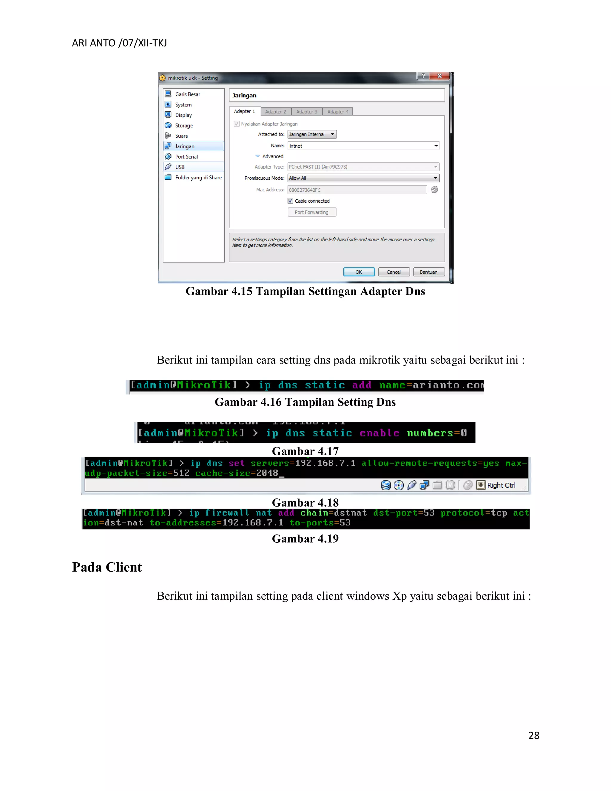 ARI ANTO /07/XII-TKJ
28
Gambar 4.15 Tampilan Settingan Adapter Dns
Berikut ini tampilan cara setting dns pada mikrotik yaitu sebagai berikut ini :
Gambar 4.16 Tampilan Setting Dns
Gambar 4.17
Gambar 4.18
Gambar 4.19
Pada Client
Berikut ini tampilan setting pada client windows Xp yaitu sebagai berikut ini :
 