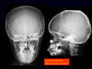 Find the pathology
What clues do you have?
 