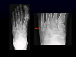 2015-08-19_Benseler_Imaging.ppt