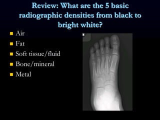 Review: What are the 5 basic
radiographic densities from black to
bright white?
 Air
 Fat
 Soft tissue/fluid
 Bone/mineral
 Metal
 