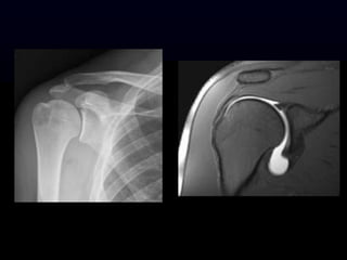 2015-08-19_Benseler_Imaging.ppt
