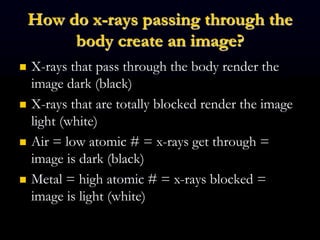 How do x-rays passing through the
body create an image?
 X-rays that pass through the body render the
image dark (black)
 X-rays that are totally blocked render the image
light (white)
 Air = low atomic # = x-rays get through =
image is dark (black)
 Metal = high atomic # = x-rays blocked =
image is light (white)
 